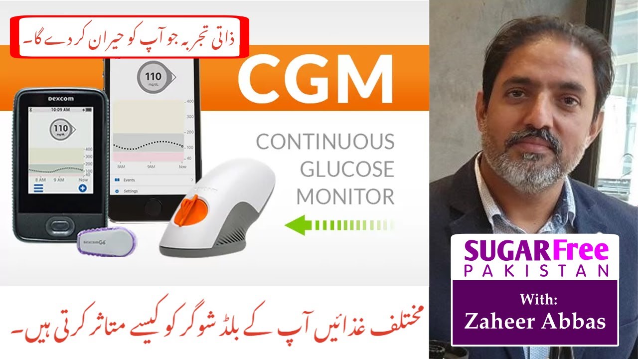 Continuous Glucose Monitoring