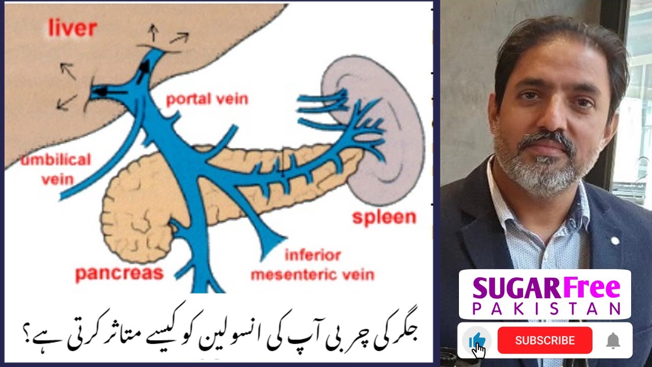Fatty liver and diabetes