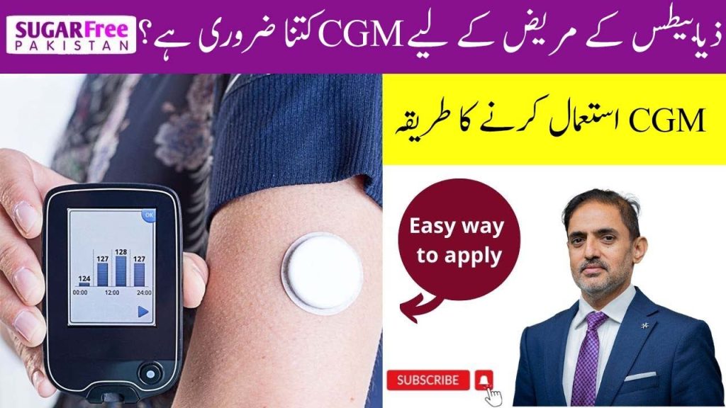How to use CGM (Continuous Glucose Monitoring)